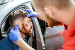 Facial Injuries From Car Accident In North Carolina