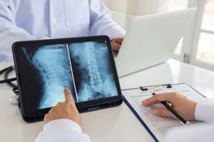 Raleigh Spinal Cord Injury Attorney